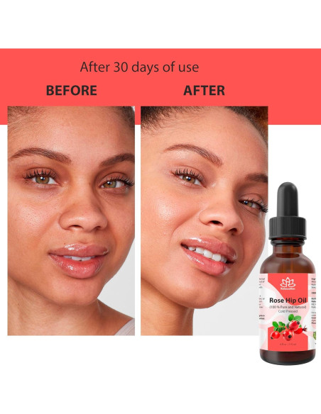 Aceite de Rosa Mosqueta Relaxcation 113.4 ml Puro y Natural