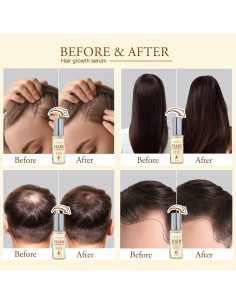 Aceite Crecimiento Cabello Biotina y Romero 50 ml - Tratamiento Anti Pérdida 2