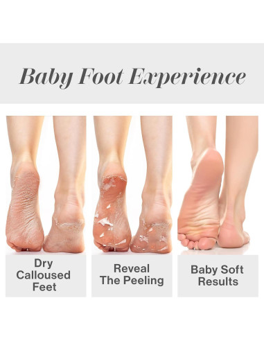 Baby Foot Exfoliante para Pies 70.87 ml - Spa en Casa
