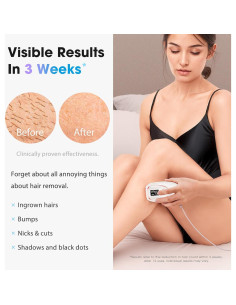 Depiladora Láser IPL Dongguan TM002 - Sin Dolor, 999K Destellos 2