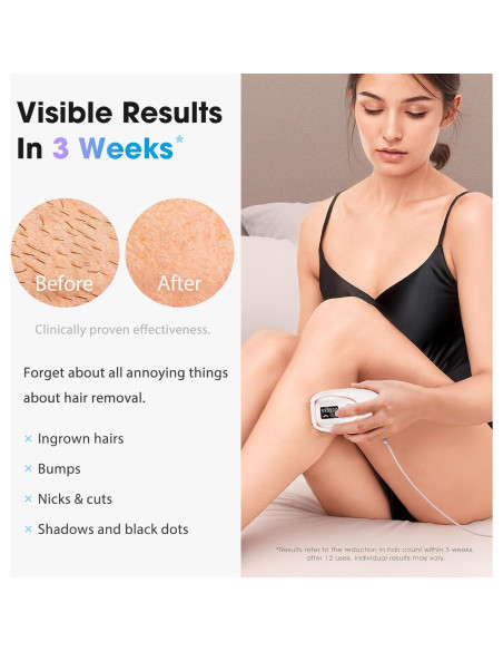 Depiladora Láser IPL Dongguan TM002 - Sin Dolor, 999K Destellos