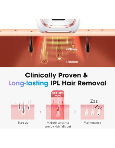 Depiladora Láser IPL Dongguan TM002 - Sin Dolor, 999K Destellos
