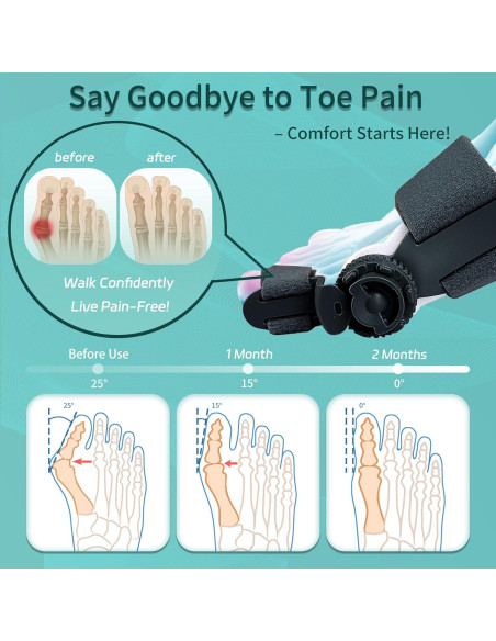 Corrector de Juanetes Veook Ajustable Negro para Alivio de Hallux Valgus