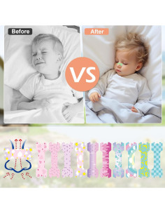 30 Tiras Nasales para Niños Aartner Rosa y Azul Antironquidos 2