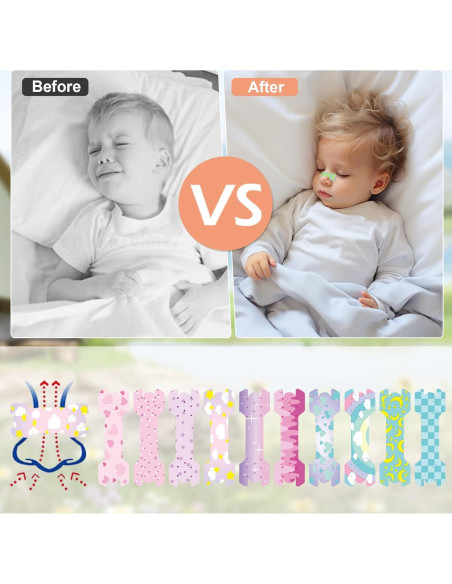 30 Tiras Nasales para Niños Aartner Rosa y Azul Antironquidos