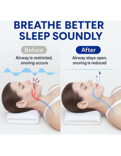 Dispositivos Anti Ronquidos Eovvoe - Paquete de 4 Reutilizables 2