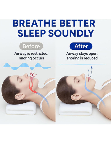 Dispositivos Anti Ronquidos Eovvoe - Paquete de 4 Reutilizables