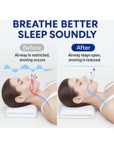 Dispositivos Anti Ronquidos Eovvoe - Paquete de 4 Reutilizables