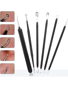 Kit de Herramientas Extractoras de Puntos Negros Tomata - 6 Piezas Acero Inoxidable 2