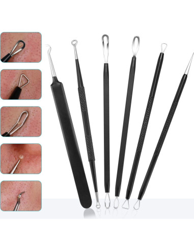 Kit de Herramientas Extractoras de Puntos Negros Tomata - 6 Piezas Acero Inoxidable