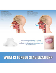 Dispositivo Antisnoring Good Morning - Protector Bucal Nocturno 2