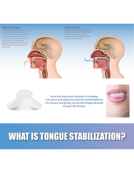 Dispositivo Antisnoring Good Morning - Protector Bucal Nocturno