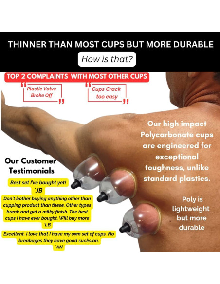 Juego de Ventosas de Terapia Profesional Cupping Warehouse - 20 Unidades