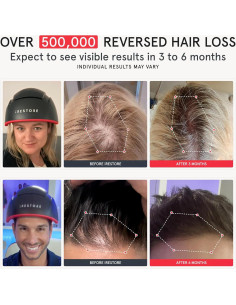 iRestore Elite - Gorro Láser para Crecimiento de Cabello 2