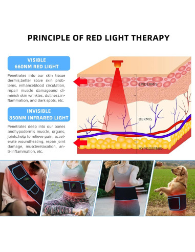 Cinturón Terapia Luz Roja Feangli Inalámbrico Alivio Dolor