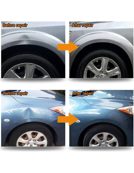 Kit de Extracción de Abolladuras FUZHUI - Universal, 0.49 kg