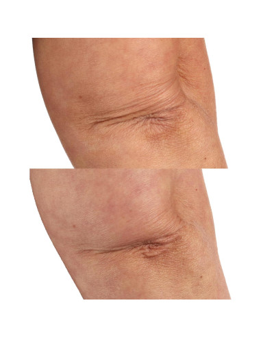 Aceite Corporal Seco Perricone MD 118.3 ml - Nutrición y Hidratación