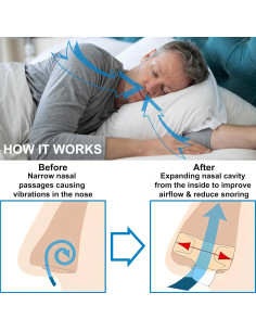 Dilatores Nasales Antirronquido UyiCare - Paquete de 4 Clips 2