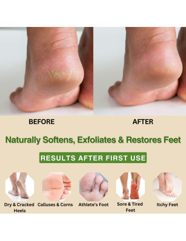 Crema hidratante para pies Natural Escapes 118 ml - Talones agrietados