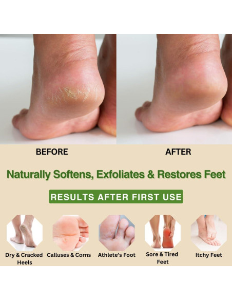 Crema hidratante para pies Natural Escapes 118 ml - Talones agrietados