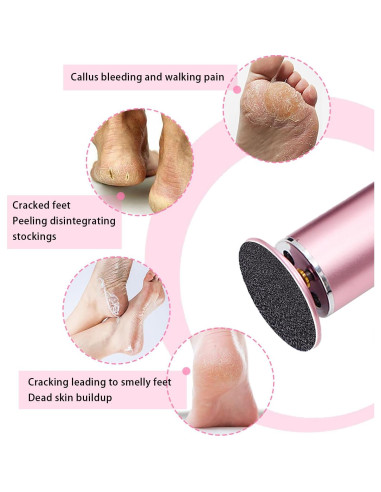 Juego de 60 Discos de Lija para Removedor de Callos HayZBao - 30 Grano Fino y 30 Grano Grueso