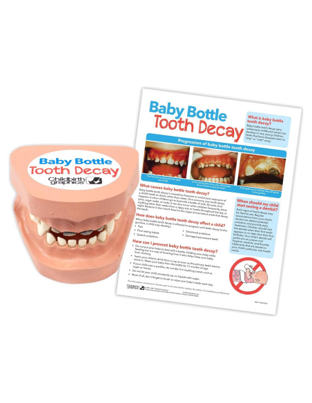 Modelo Educativo de Caries por Biberón - 2 Piezas