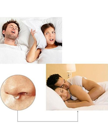 Juego de 8 Dilatadores Nasales Antisnoring Premium - Previene Ronquidos