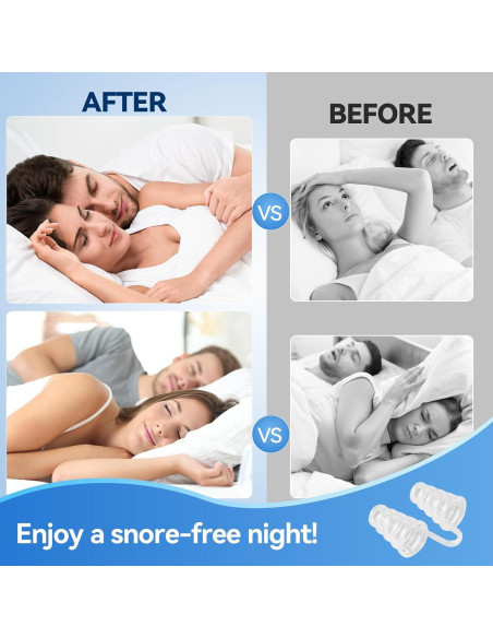 Dilatadores Nasales Anti Ronquidos SARSWBBHI - 8 Tamaños