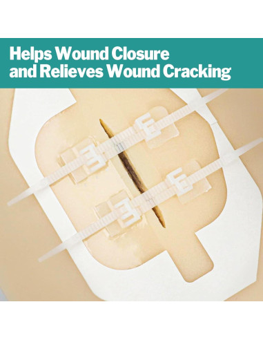 AZEN Kit de Cierre de Heridas 10 Tiras Vendajes Mariposa