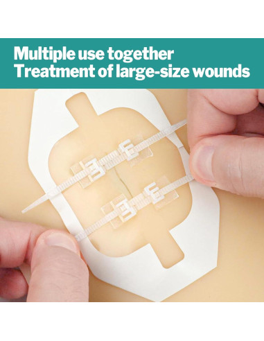 AZEN Kit de Cierre de Heridas 10 Tiras Vendajes Mariposa