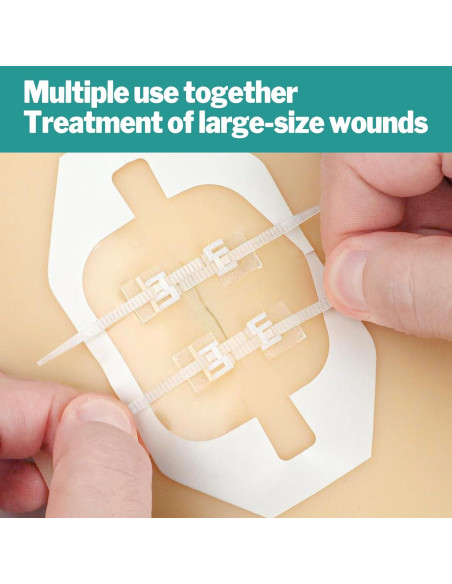 AZEN Kit de Cierre de Heridas 10 Tiras Vendajes Mariposa