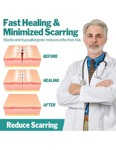 AZEN Kit de Cierre de Heridas 10 Tiras Vendajes Mariposa