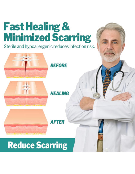 AZEN Kit de Cierre de Heridas 10 Tiras Vendajes Mariposa