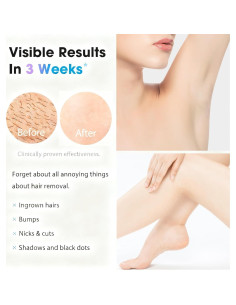 Depiladora Láser IPL Gransumr - Eliminación Permanente de Vello 2