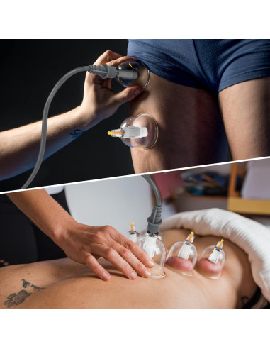 Juego de Ventosas Terapéuticas Muchoo - 22 Piezas con Bomba