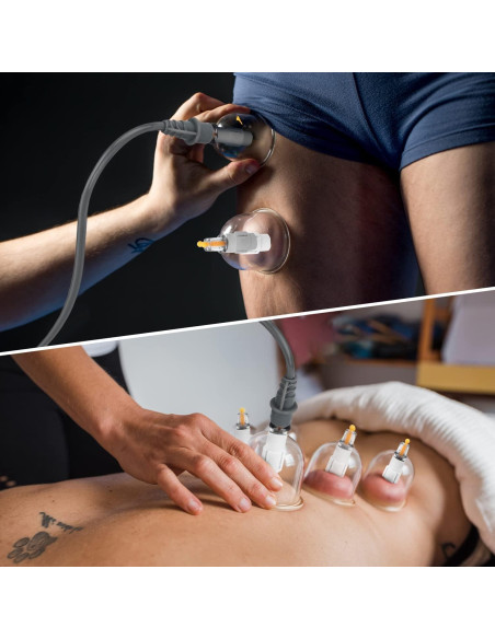 Juego de Ventosas Terapéuticas Muchoo - 22 Piezas con Bomba