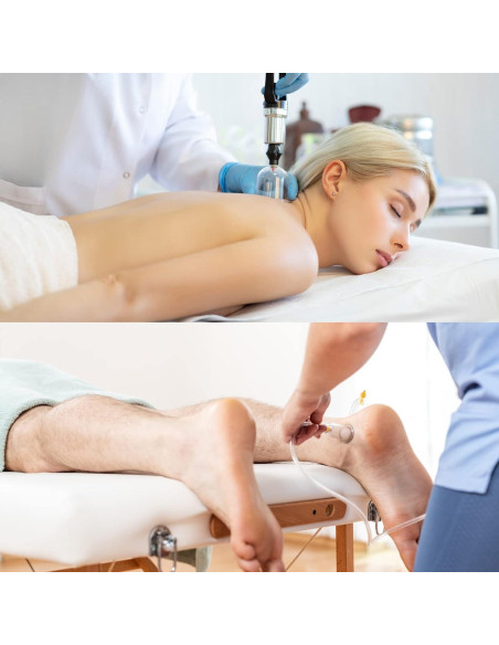 Juego de Ventosas Terapéuticas Muchoo - 22 Piezas con Bomba