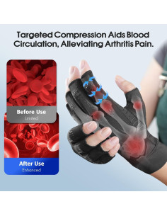 Guantes de compresión de cobre Donfri para artritis - Unisex XL 2