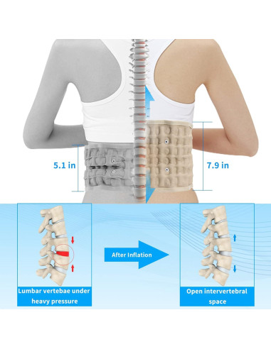 Cinturón de Descompresión Lumbar 6Xigouma Beige Talla Única