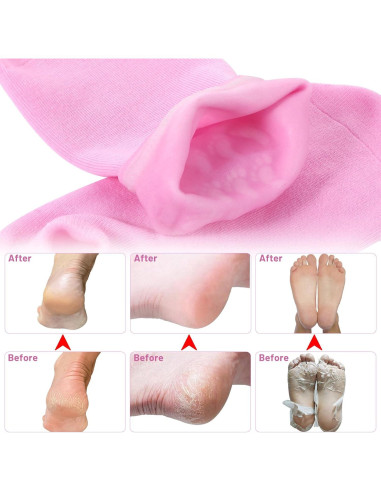 Calcetines Hidratantes de Gel Hpmjz para Pies Secos - Rosa