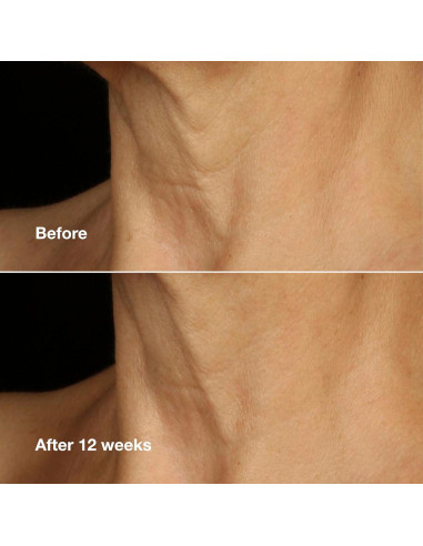 Crema Lifting Clinique Smart Clinical Repair 50 ml Anti Envejecimiento