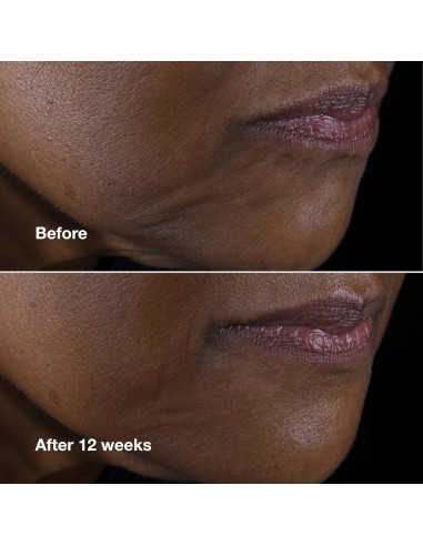 Crema Lifting Clinique Smart Clinical Repair 50 ml Anti Envejecimiento