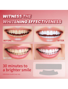Tiras Blanqueadoras de Dientes Lanlwos 28 Unidades Sensibles 2