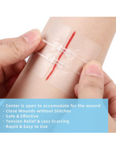 Cierres de Heridas LotFancy 4 Unidades Estériles Primeros Auxilios 2