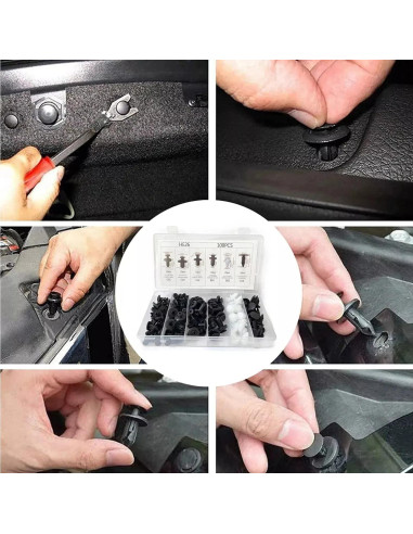 Kit de 100 Clips de Parachoques Nylon ZMSHANGMAO 6 Tamaños