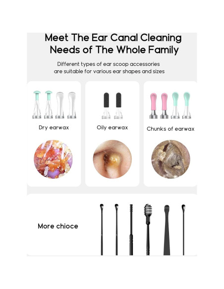 Limpiador de Cera de Oídos Bebird C3 con Cámara 1080p