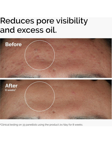 Suero El Ordinario Niacinamida 10% + Zinc 1% 30ml