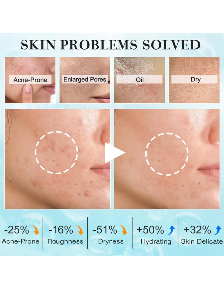 Set Cuidado Facial FITOEG para Mujeres y Adolescentes