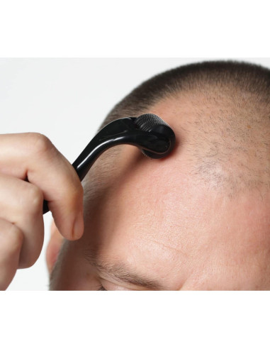 Derma Roller RoselynBoutique 540 Microagujas Titanio