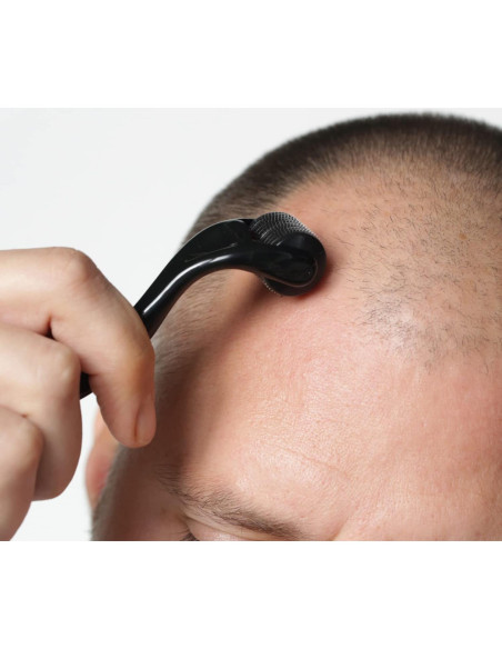 Derma Roller RoselynBoutique 540 Microagujas Titanio